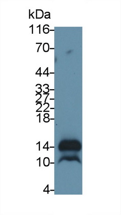 MAB656Hu21.jpg