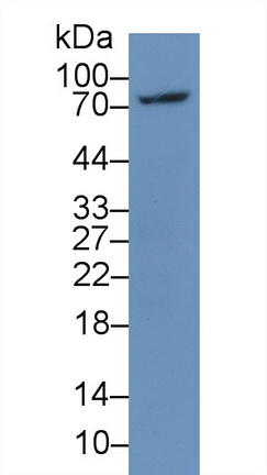 Monoclonal Antibody to Lymphocyte Activation Gene 3 (LAG3)