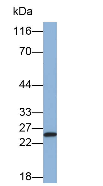 MAB685Hu21.jpg