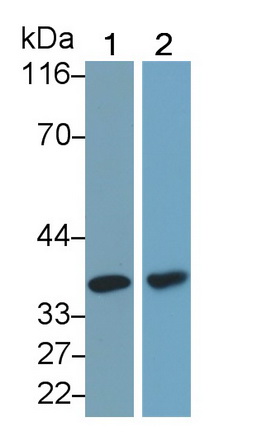 Monoclonal Antibody to Lactate Dehydrogenase B (LDHB)