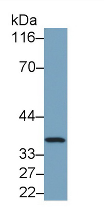 Monoclonal Antibody to Lactate Dehydrogenase B (LDHB)