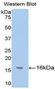 Monoclonal Antibody to Fibroblast Growth Factor Receptor 1 (FGFR1)