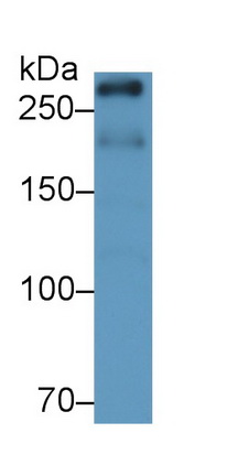 Monoclonal Antibody to Serine/threonine-protein kinase mTOR (mTOR)