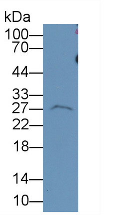 MAB833Hu21.jpg