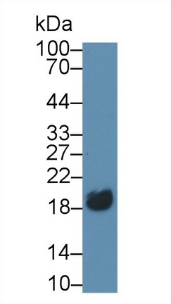 MAB872Hu21.jpg