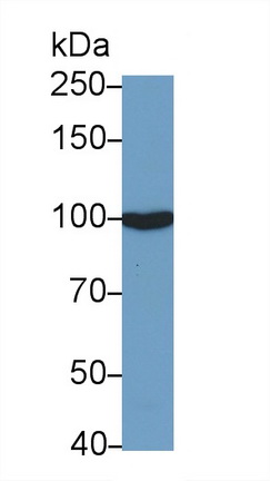 Monoclonal Antibody to Angiotensin I Converting Enzyme 2 (ACE2)