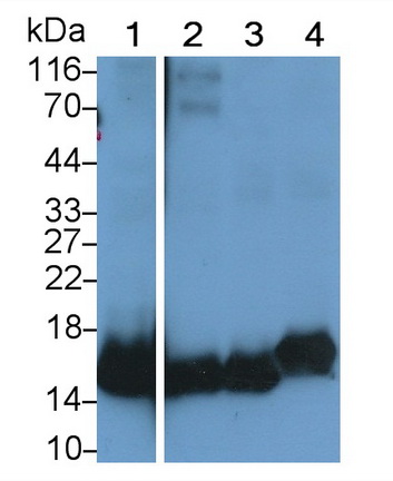 Monoclonal Antibody to Superoxide Dismutase 1 (SOD1)