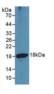 MAB973Hu21.jpg