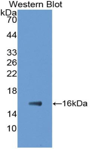 MAB985Hu22.jpg