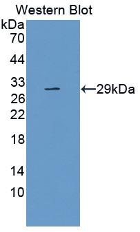 MAB990Hu21.jpg