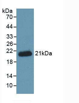 Monoclonal Antibody to Hemojuvelin (HJV)