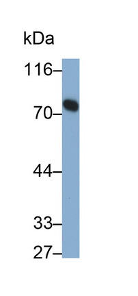 Monoclonal Antibody to Transferrin (TF)