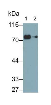 Monoclonal Antibody to Transferrin (TF)