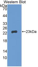 Monoclonal Antibody to Gremlin 1 (GREM1)