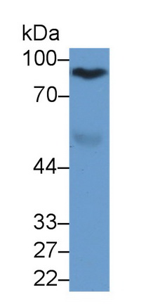 Monoclonal Antibody to Afamin (AFM)