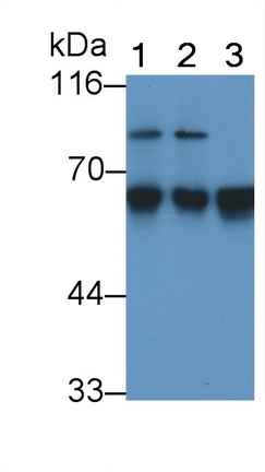 Monoclonal Antibody to Antithrombin (AT)