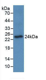 Monoclonal Antibody to Osteoclast Associated Receptor (OSCAR)