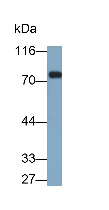 Monoclonal Antibody to Carcinoembryonic Antigen Related Cell Adhesion Molecule 1 (CEACAM1)