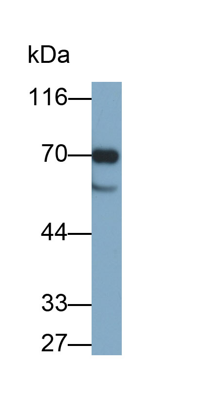 Monoclonal Antibody to Carcinoembryonic Antigen Related Cell Adhesion Molecule 1 (CEACAM1)