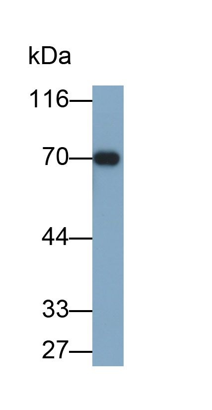 Monoclonal Antibody to Carcinoembryonic Antigen Related Cell Adhesion Molecule 1 (CEACAM1)