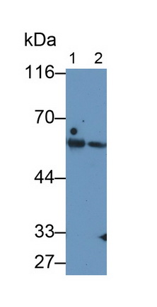 Monoclonal Antibody to Carcinoembryonic Antigen Related Cell Adhesion Molecule 1 (CEACAM1)