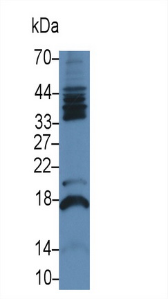 Monoclonal Antibody to Follicle Stimulating Hormone Beta (FSHb)