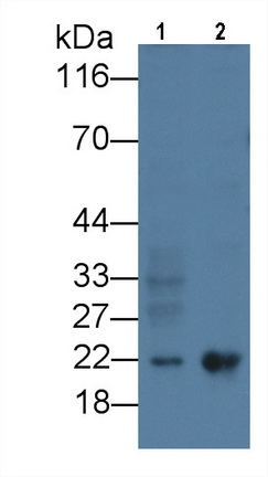 Monoclonal Antibody to Ferritin, Heavy Polypeptide (FTH)