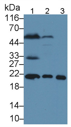 Monoclonal Antibody to Ferritin, Heavy Polypeptide (FTH)