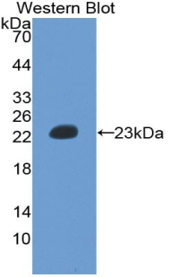 Monoclonal Antibody to Hemoglobin Beta (HBb)