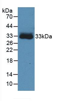 Monoclonal Antibody to Hemoglobin Beta (HBb)