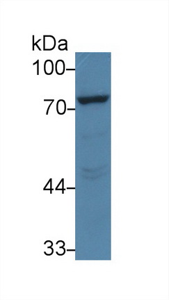 Monoclonal Antibody to Proprotein Convertase Subtilisin/Kexin Type 9 (PCSK9)