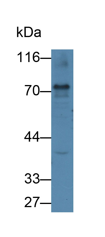 Monoclonal Antibody to Proprotein Convertase Subtilisin/Kexin Type 9 (PCSK9)