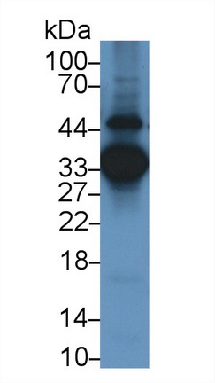 Monoclonal Antibody to Annexin A3 (ANXA3)