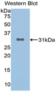 Monoclonal Antibody to Sirtuin 3 (SIRT3)