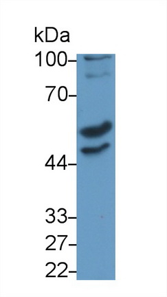 Monoclonal Antibody to Doublecortin Like Kinase 1 (DCLK1)