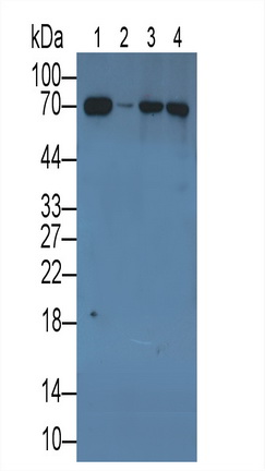 MAF548Hu21.jpg