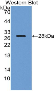 Monoclonal Antibody to Lysyl Oxidase Like Protein 1 (LOXL1)