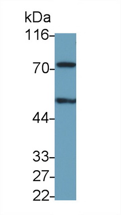 Monoclonal Antibody to Peptidyl Arginine Deiminase Type VI (PADI6)