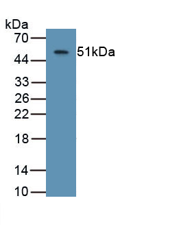 Monoclonal Antibody to Aspartate Beta Hydroxylase (ASPH)