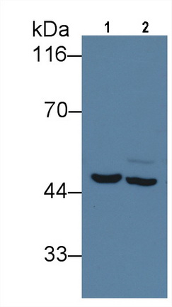 Monoclonal Antibody to Isocitrate Dehydrogenase 1, Soluble (IDH1)