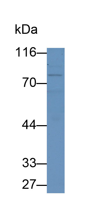 MAL763Hu22.jpg