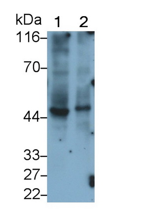 MAQ943Hu22.jpg