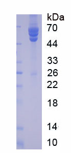 Native Fibrinogen (FG)