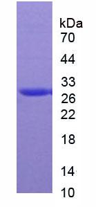 Native Carbonic Anhydrase II (CA2)