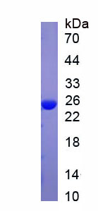 Native C Reactive Protein (CRP)