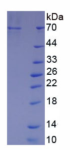 Native Albumin (ALB)