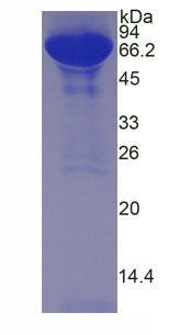 Native Albumin (ALB)