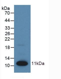 Polyclonal Antibody to S100 Calcium Binding Protein (S100)