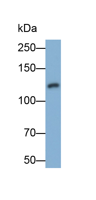 Polyclonal Antibody to E-cadherin