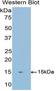 Polyclonal Antibody to E-cadherin